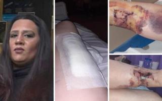 Ashiya Hussain and Donna Ormerod's horrific injuries