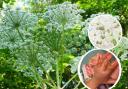 Lancs’ giant hogweed hotspots after child burned by UK’s most dangerous plant