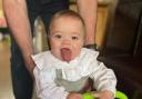 Mum of baby with rare condition raising money for life-changing tongue surgery