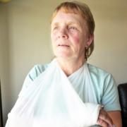 DOG HUNT: Jean Dunston, who was attacked by a German Shepherd