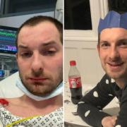 Adam in hospital before going into rehab (left) and him during his stay at Littledale (right)
