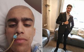 Gorani Peyman in hospital (L) and Gorani after his recovery (R)