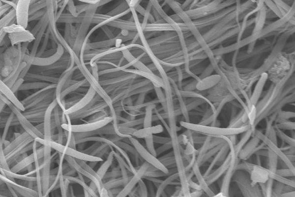 Lancashire Telegraph: : A high magnification picture using a scanning electron microscope (SEM) photo of some echinogammarus marinus sperm (University of Portsmouth/PA)