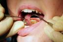 NHS dentistry is critical Image: Rui Vieira/PA Wire