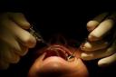 There is a shortage of dentists in towns across Lancashire