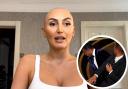 Preston’s ZaraLena Jackson spoke about her alopecia and the Will Smith and Chris Rock slap on Instagram and GB News. (Photo: GB News, Chris Pizzello/AP)
