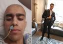 Gorani Peyman in hospital (L) and Gorani after his recovery (R)