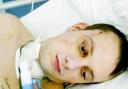 BATTERED Matthew Edgington in hospital after his attack while on a night out in Manchester