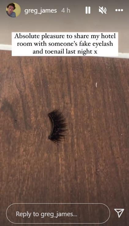 Lancashire Telegraph: Greg James found a fake eyelash and toenail in his Burnley hotel room (Photo: Instagram/@greg_james) Lancashire Telegraph: Greg James found a fake eyelash and toenail in his Burnley hotel room (Photo: Instagram/@greg_james)