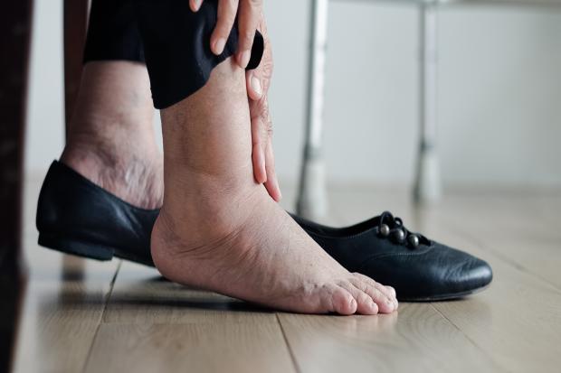 In the UK, neuropathic pain is present in 10% of the general population with symptoms including a burning, stabbing, prickling or aching sensation in the legs or feet.