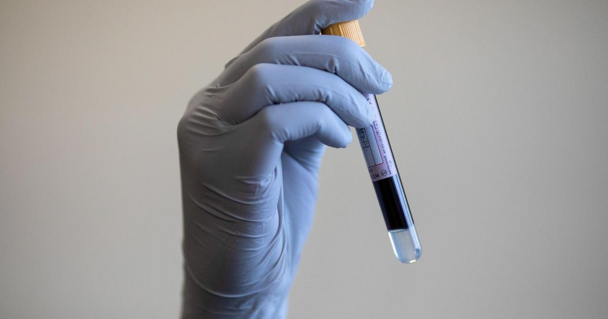 Blood test to determine organ age could help predict disease risk - Vimarsana News