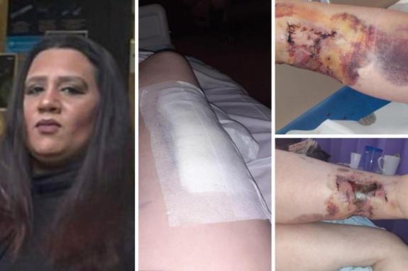 Lancashire Telegraph: Ashiya Hussain and Donna Ormrod's injuries Lancashire Telegraph: Ashiya Hussain and Donna Ormrod's injuries