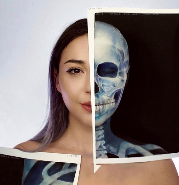 Lancashire Telegraph: Natasha Jane Wood as a x-ray skeleton Lancashire Telegraph: Natasha Jane Wood as a x-ray skeleton