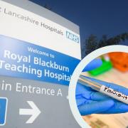 New coronavirus deaths recorded in East Lancashire's hospitals over the weekend