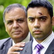 CALM Shahid Malik with his father Rafique, the Deputy Mayor of Burnley, shows his injuries at his home in Burnley