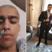 Gorani Peyman in hospital (L) and Gorani after his recovery (R)