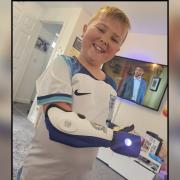 Alexander Sparkes, seven, with his Blackburn Rovers sleeve for bionic arm