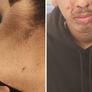 The family released some of the images they took of the bloodied teenager as they took him to hospital.