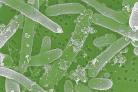 Specialists from Public Health England and environmental health officers are investigating the cases of E.coli O157