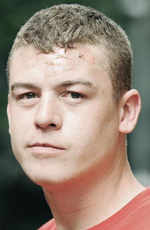 Blackburn man sets head alight in hairspray accident
