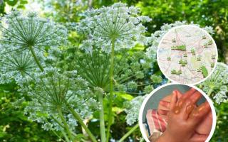 Lancs’ giant hogweed hotspots after child burned by UK’s most dangerous plant