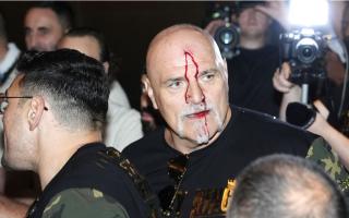 John Fury sustained a cut and the rival camps had to be separated